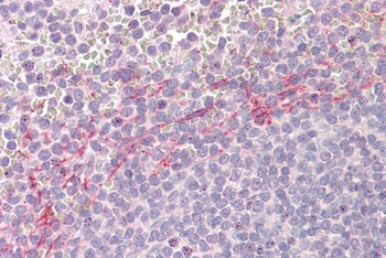 UBASH3A Antibody