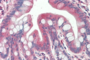 Sap30L Antibody
