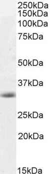 Smgc Antibody
