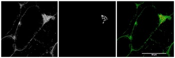 PRKAA2 Antibody