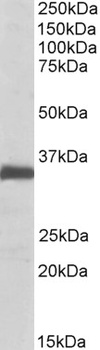 PRKAA2 Antibody