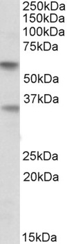 PRKAA2 Antibody