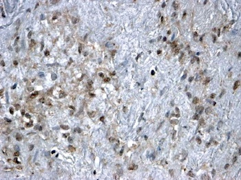 FOXL2 Antibody