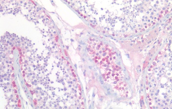 NDUFS7 Antibody