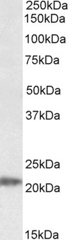 ETFB Antibody