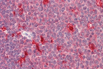 HOXB9 Antibody