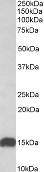 TPPP Antibody