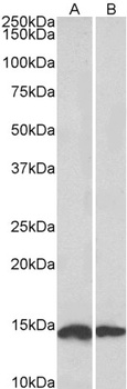 TPPP Antibody