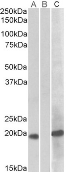 TPPP Antibody