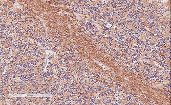 TIAL1 Antibody