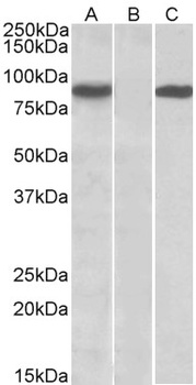 NDUFS6 Antibody