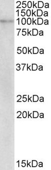 NDUFS6 Antibody