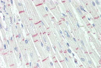 STAG2 Antibody