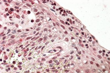 STAG2 Antibody