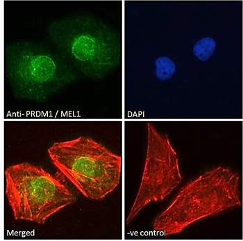 GPR17 Antibody