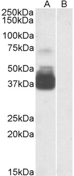 CANX Antibody
