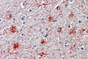 CANX Antibody