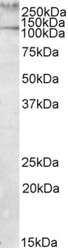 P2RX7 Antibody