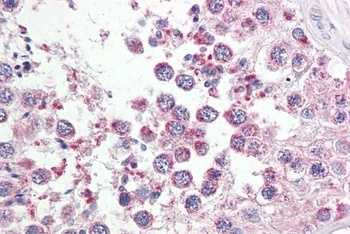 P2RX7 Antibody