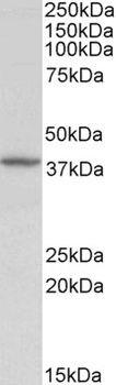 HTR3B Antibody
