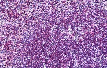 ITGAL Antibody