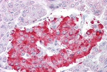KCNQ1 Antibody
