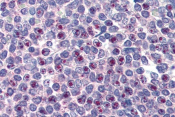 FOXC1 Antibody