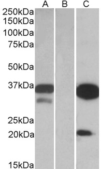 CMA1 Antibody