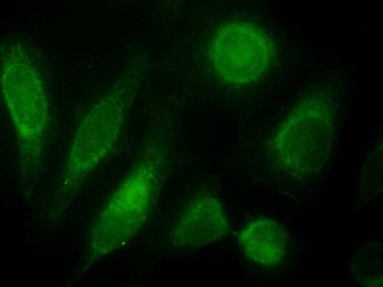 TRPV2* Antibody