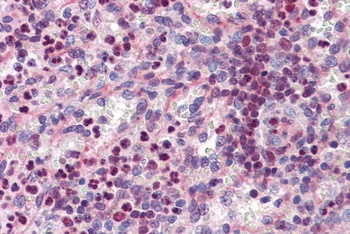 DACH1 Antibody