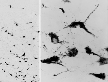 SYT1 Antibody