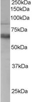 TRAK2 Antibody