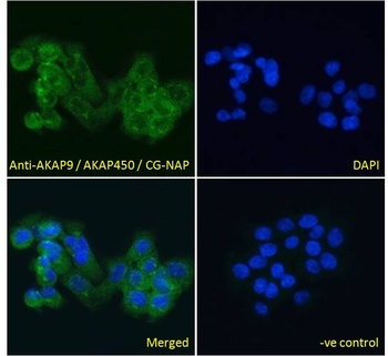 ASPN Antibody