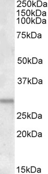 ATF5 Antibody