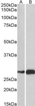 ATF5 Antibody