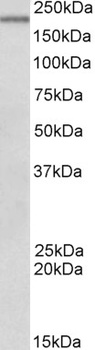RAN Antibody