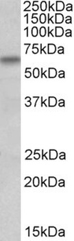 RAN Antibody