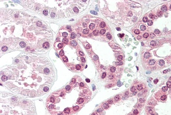 POLDIP2 Antibody