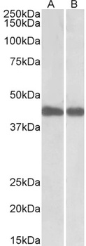 PCBP1 Antibody