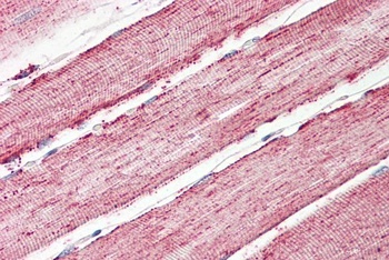 PCBP1 Antibody