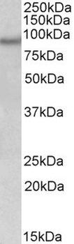 ALDH6A1 Antibody