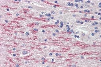 ALDH5A1 Antibody