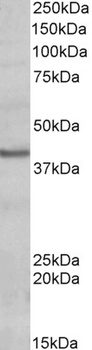 HLA-DQA2 Antibody