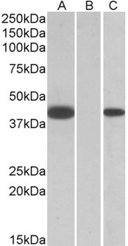 LIMS2 Antibody