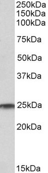 BIRC3 Antibody