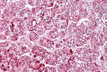 PSMB9 Antibody