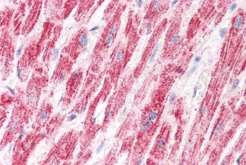 PSMB9 Antibody