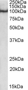 IGF1 Antibody