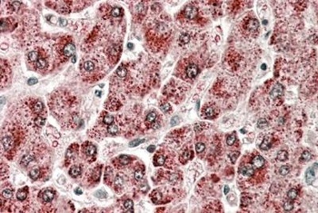 LMTK2 Antibody