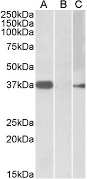 PSMB7 Antibody